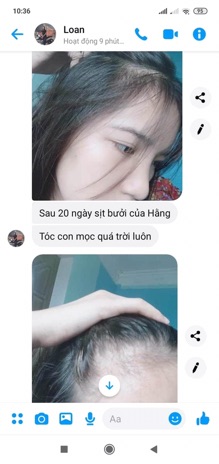 COMBO 3 CHAI TINH DẦU BƯỞI KÍCH MỌC TÓC ( tặng quà hấp dẫn )