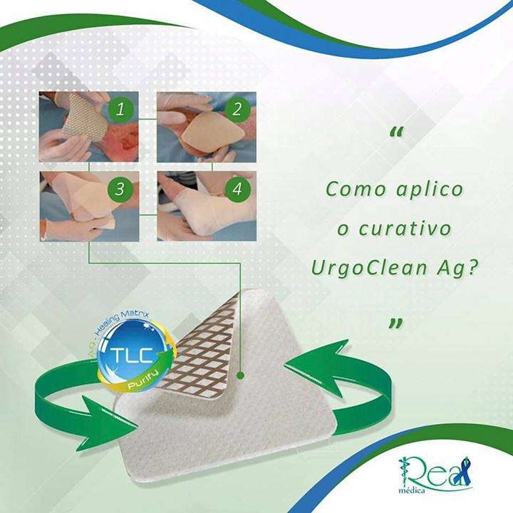 Gạc UrgoClean Ag giúp chống lại nhiễm khuẩn cục bộ kt 10x10cm 01 miêng