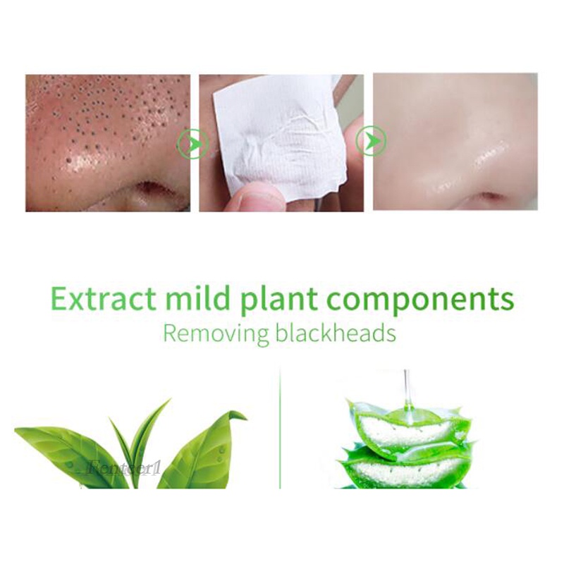 [Hàng mới về] Set 160 miếng dán lột mụn đầu đen làm sạch lỗ chân lông không chứa dầu