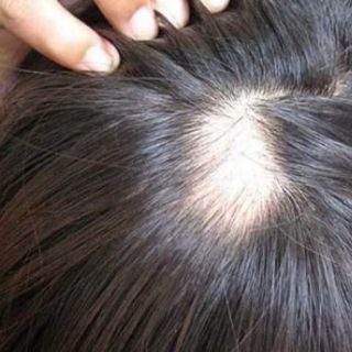 DẦU GỘI DẦU NASIL HEVINA