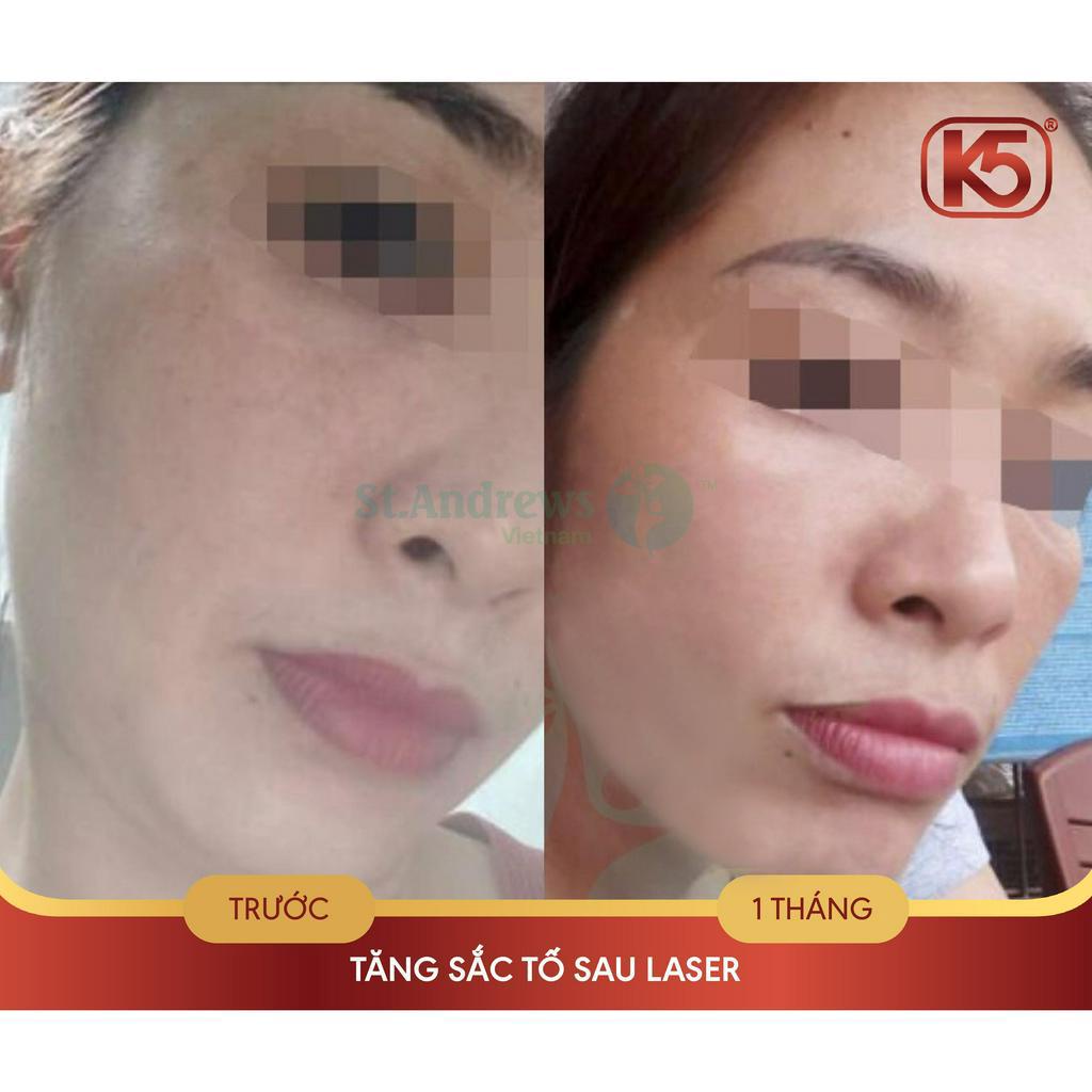 Kem sáng da, mờ thâm sạm K5 Lipogel 40ml - đẩy lùi nám, giúp da sáng đều màu