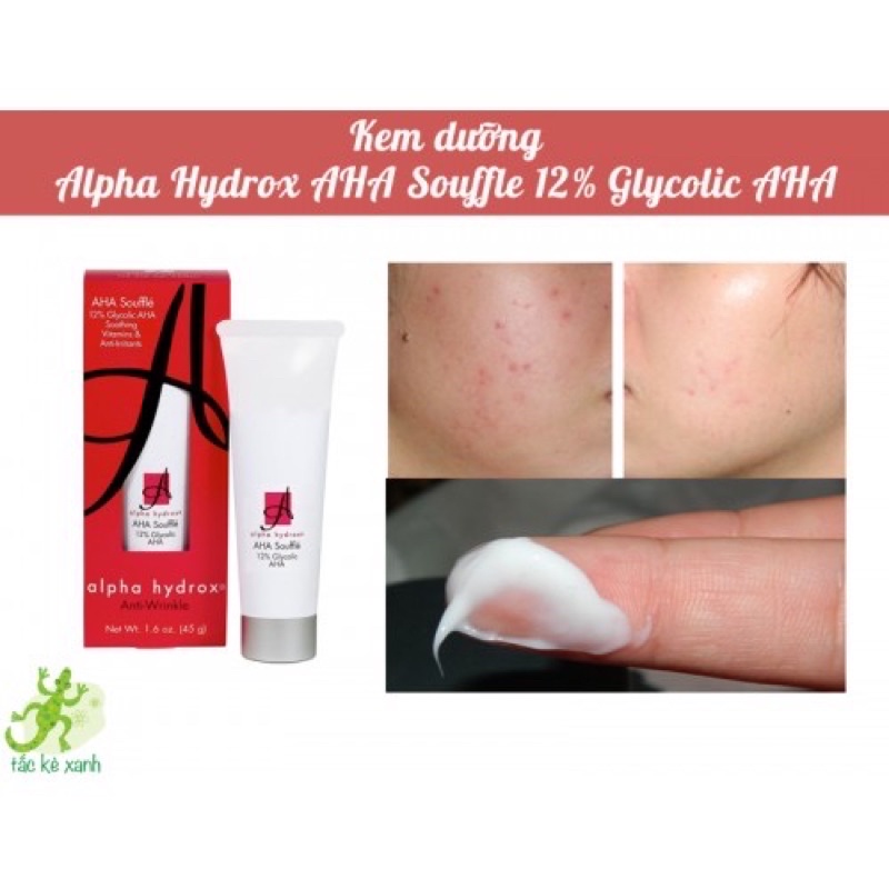 Tẩy da chết hóa học Alpha Hydrox AHA soufflé 12% Glycolic Aha | BigBuy360 - bigbuy360.vn