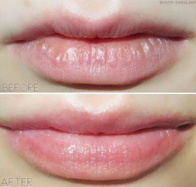 🌷🌷Tẩy tế bào chết cho môi Beauty Treats Sugar lip scrub dạng tuýp. | BigBuy360 - bigbuy360.vn