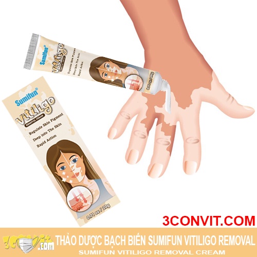 Thảo dược bôi bạch biến Sumifun Vitiligo Removal