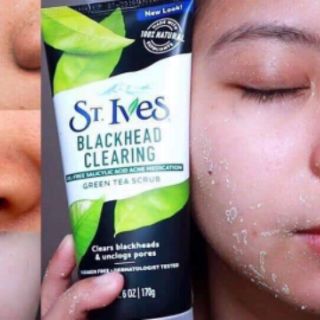 SỬA RỬA MẶT ST IVES TRÀ XANH