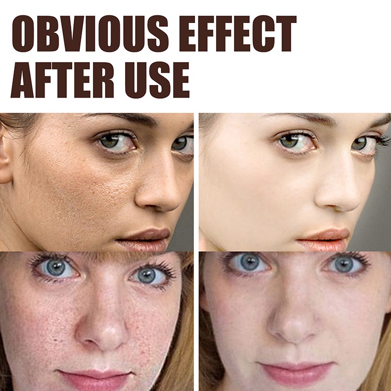 Kem Retinol EELHOE Chống Lão Hóa Chống Nếp Nhăn Làm Sáng Da