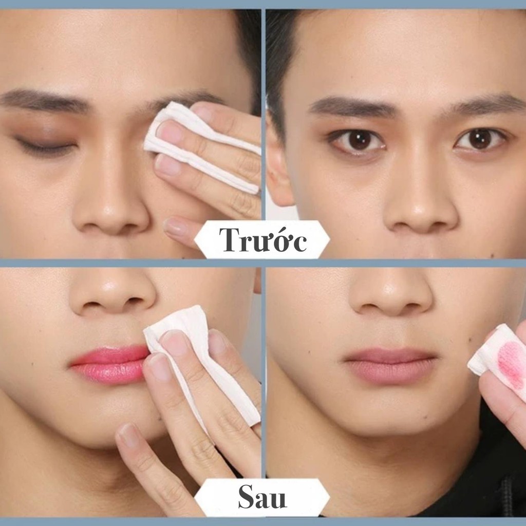 Tẩy Trang KHÔNG Gây Kích Ứng Trên Da - Ziaja Med | BigBuy360 - bigbuy360.vn