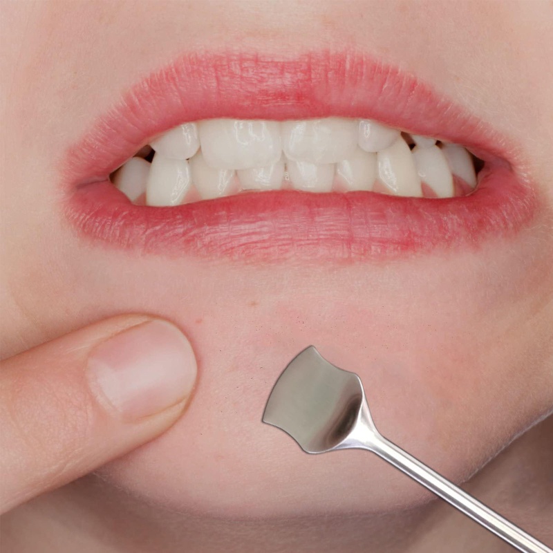 Dụng Cụ Lấy Mụn Đầu Đen YOUYO Bằng Thép Không Gỉ Chuyên Nghiệp