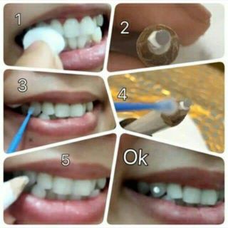 Combo 30 Viên Đá Đính Răng ( Tặng Kèm Keo Dán Và Bút - kèm hướng dẫn dễ dán tại nhà )