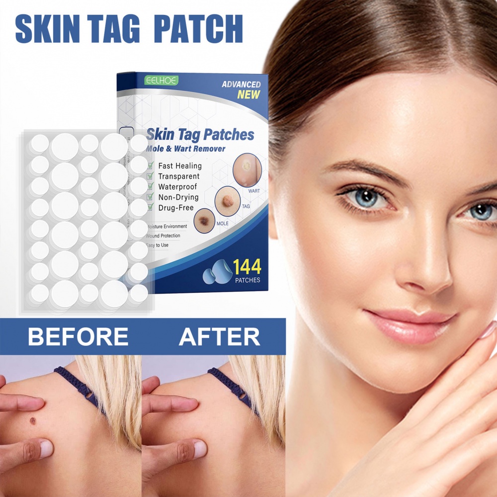 Hộp 144 Miếng Dán Loại Bỏ Mụn Cóc An Toàn Không Đau Cho Mọi Loại Da