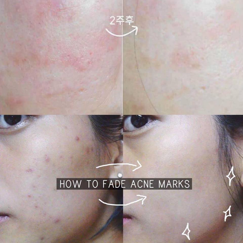 Tinh Chất Vitamin C Klairs Freshly Juiced Vitamin Drop