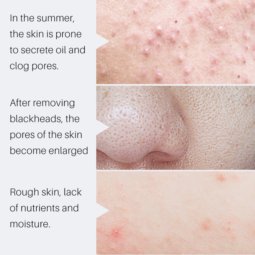 Se Khít Lỗ Chân Lông Kiểm Soát Dầu Chống Lão Hóa Làm Trắng Sáng Da 10ml