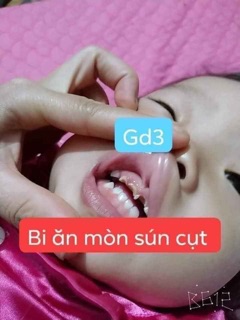 Thảo dược về răng miệng Lợi An