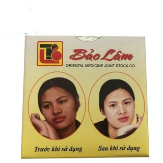 Kem Mụn trắng da Bảo Lâm 10g