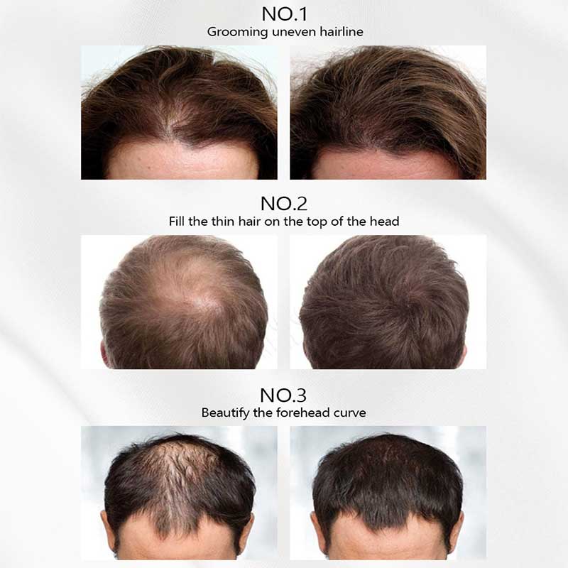 Phấn Che Khuyết Điểm Chân Tóc Chống Thấm Nước Với 5 Màu Lựa Chọn Dành Cho Cả Nam Và Nữ