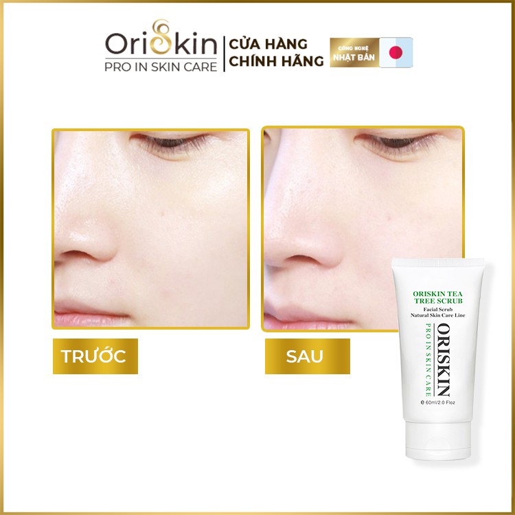 Kem Tẩy Tế Bào Chết Cho Da Mặt  Oriskin Tea Tree, Dưỡng Sáng Da Mặt, Loại Bỏ Lớp Bụi Bẩn, Cấp Ẩm Cho Da Khô. | BigBuy360 - bigbuy360.vn