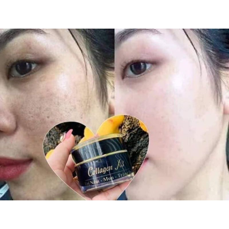 kem face dưỡng trắng giảm mụn thâm nám tàn nhang collagen x3 chính hãng tem bảy mẫu