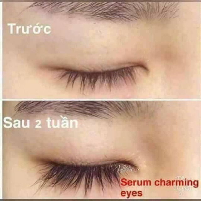 Serum Dưỡng Mi Charming Eyes Hàn Quốc date tháng 10.2022