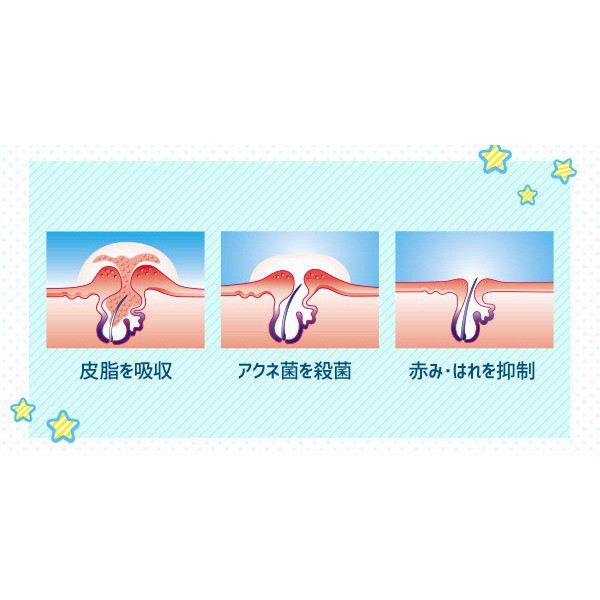 GEL BÔI MỤN DELACIN T NHẬT BẢN (TUÝP 10GR) | BigBuy360 - bigbuy360.vn