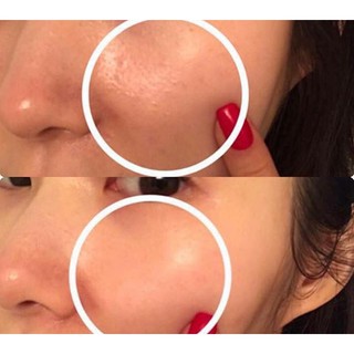 Serum Red Peel Tingle Serum -So’Natural