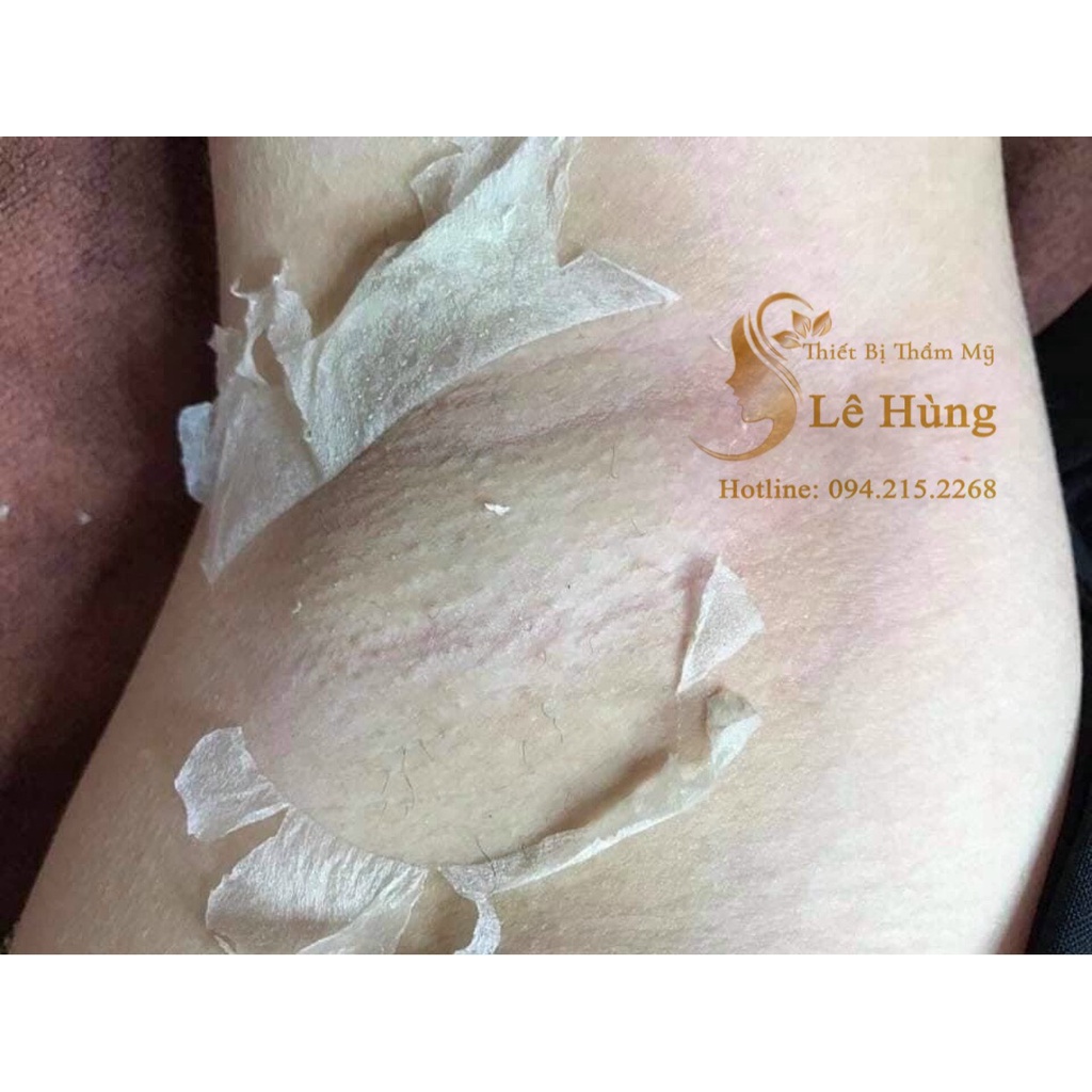 PEEL PINK TCA Hồng Nhũ Hoa  - Peel thâm nách, nhũ hoa, bẹn, mông...chuyên dùng cho spa và TMV hàng mới nhất 2022