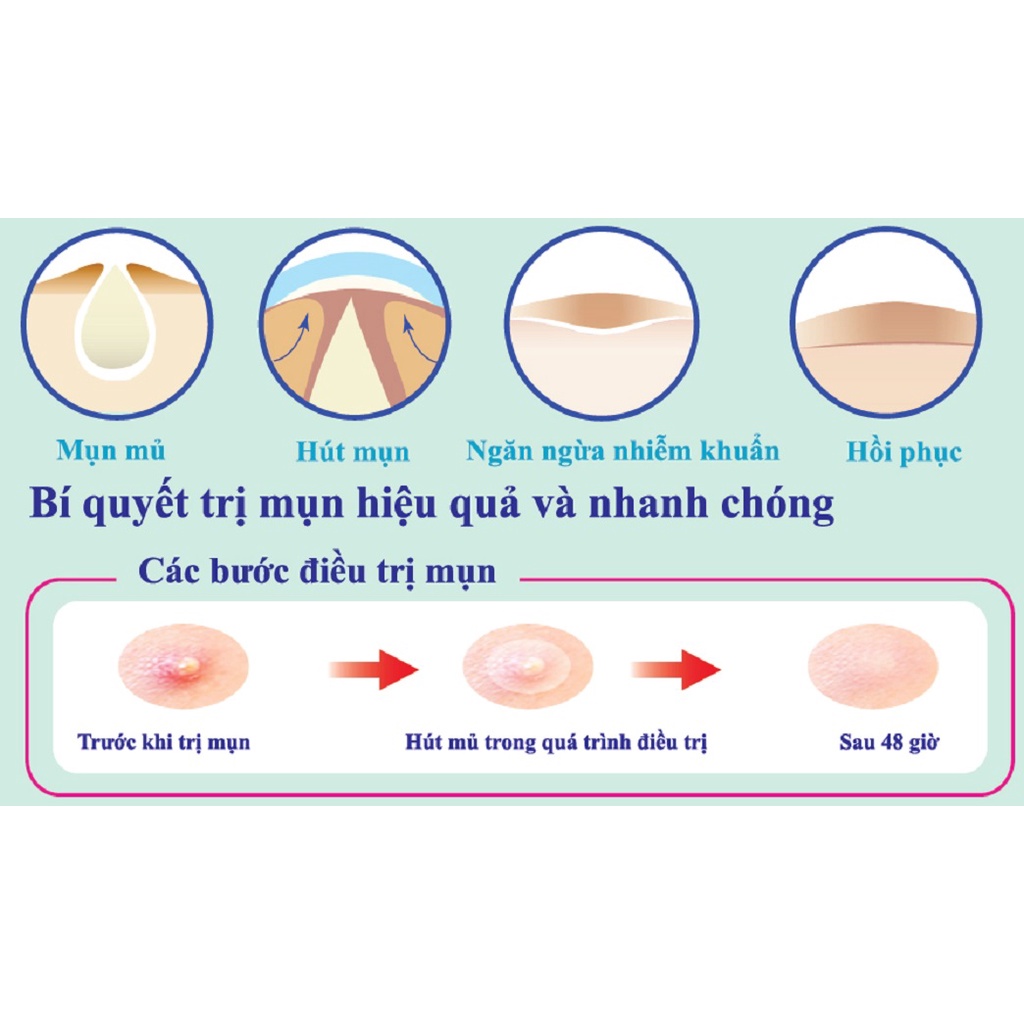 Miếng dán mụn Mayan Care 20 miếng (12 miếng 1cm + 8 miếng 0.8cm)