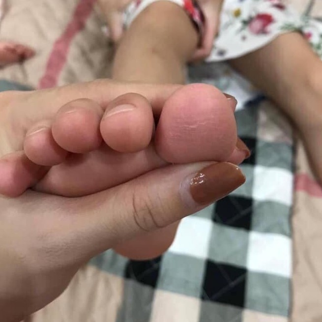 Kem chống nứt nẻ á sừng cho tay chân - Siêu hot cho mùa đông | BigBuy360 - bigbuy360.vn