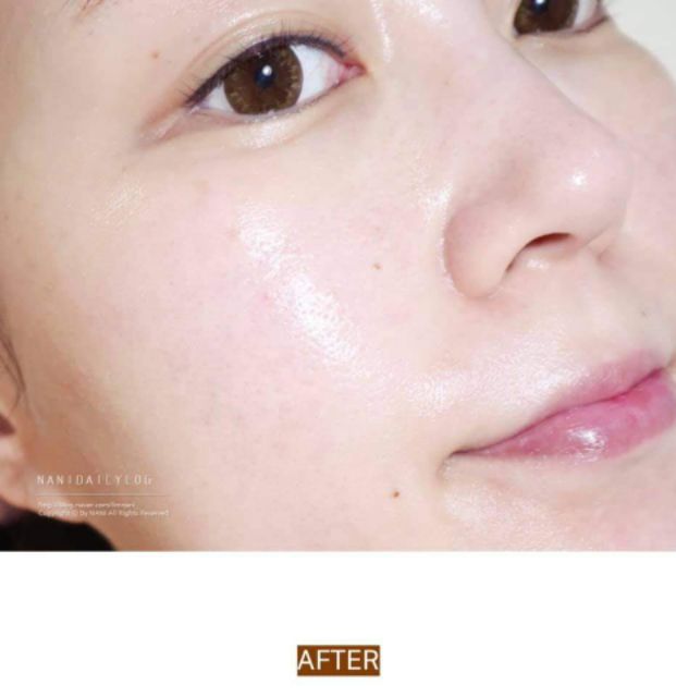 Kem dưỡng phục hồi da Probiotics reverse cream Ildong