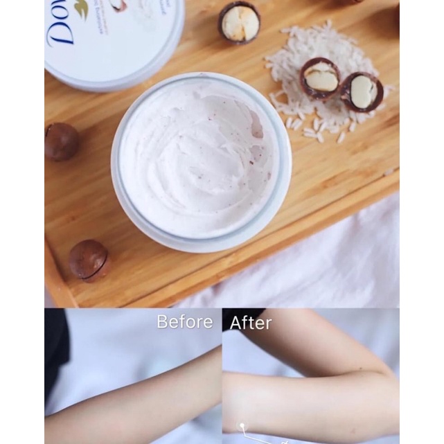Tẩy da chết Dove bản Đức 225ml