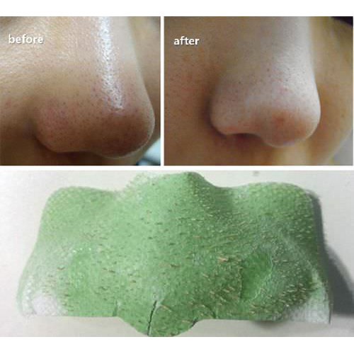 Mặt Nạ Lột Mụn Mũi Trà Xanh Etude Green Tea Nose Pack