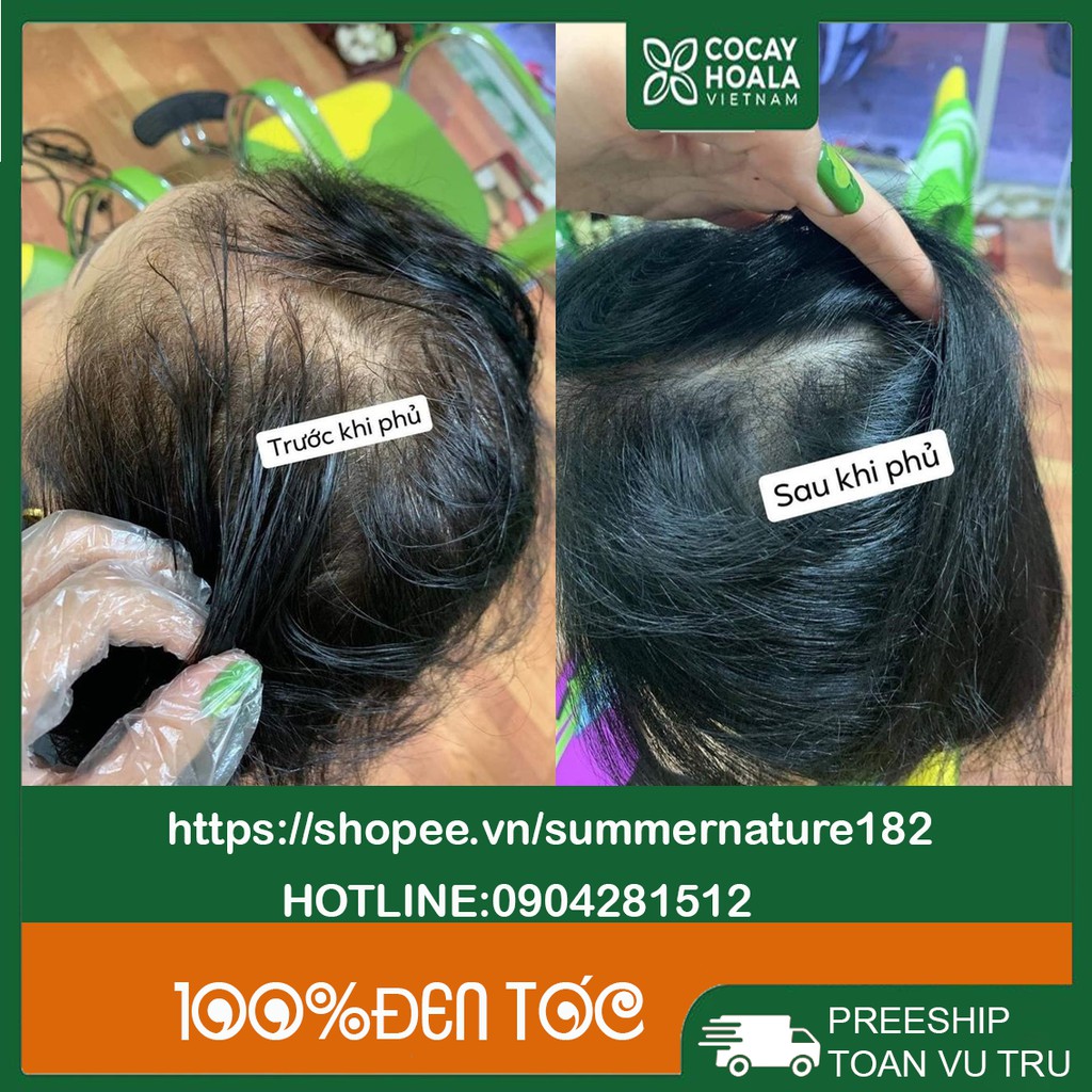 Thuốc nhuộm tóc, dầu gội đầu thảo dược đen Tóc Lich 5 Hộp 10 gói. Thuốc nhuộm đen tóc hoàn toàn từ thảo dược thiên nhiê | BigBuy360 - bigbuy360.vn