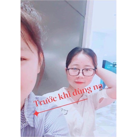 MẶT NẠ YẾN TƯƠI COLLAGEN GIÚP DƯỠNG DA GIẢM THÂM MỤN NÁM, ĐỀU MÀU DA