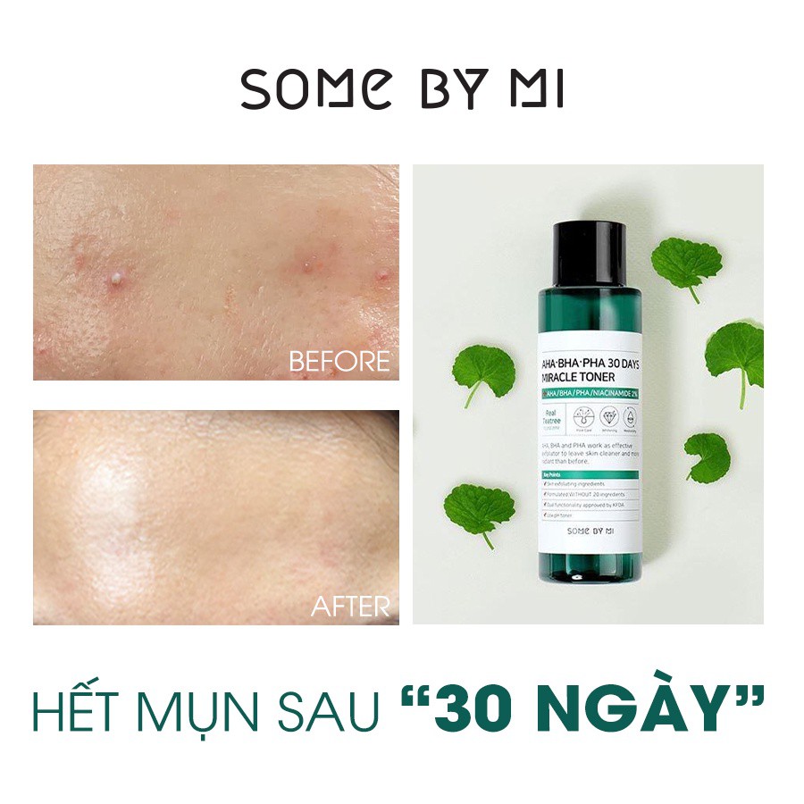 Nước Hoa Hồng Giảm Mụn Some By Mi AHA-BHA-PHA 30 Days Miracle Toner 150ml