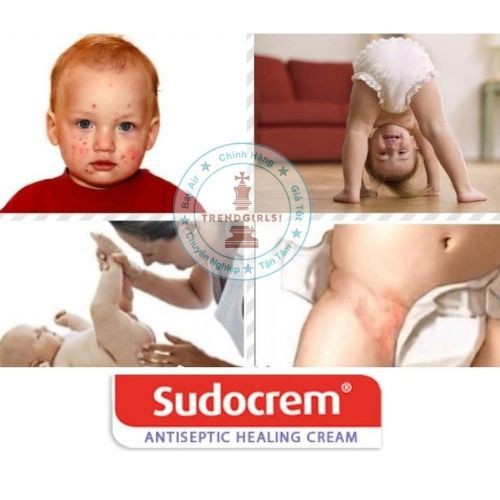 Kem bôi Sudocrem Antiseptic Healing Cream, UK (60g) chống hăm, chàm, bỏng, xước da cho trẻ em và người lớn - Trend Girls