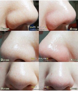 Miếng Dán Hút Mụn Good-Bye Black Head Cotton Mask Ciracle