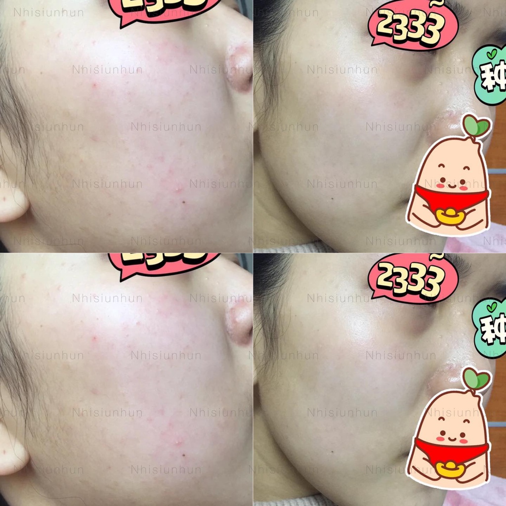 Bộ Kem dưỡng La Roche Posay Cicaplast Baume B5 - 40ml