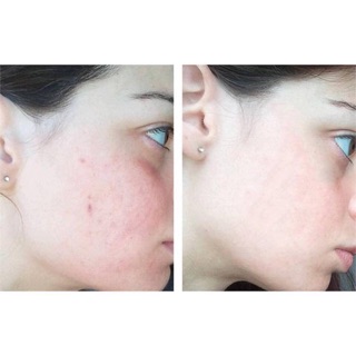 (Ảnh thật) SERUM NIACINAMIDE T.O