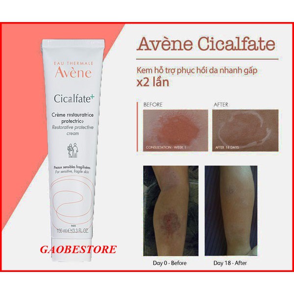 Kem Giảm Thâm Phục Hồi Da  Avène Cicalfate Repair Cream  40ml