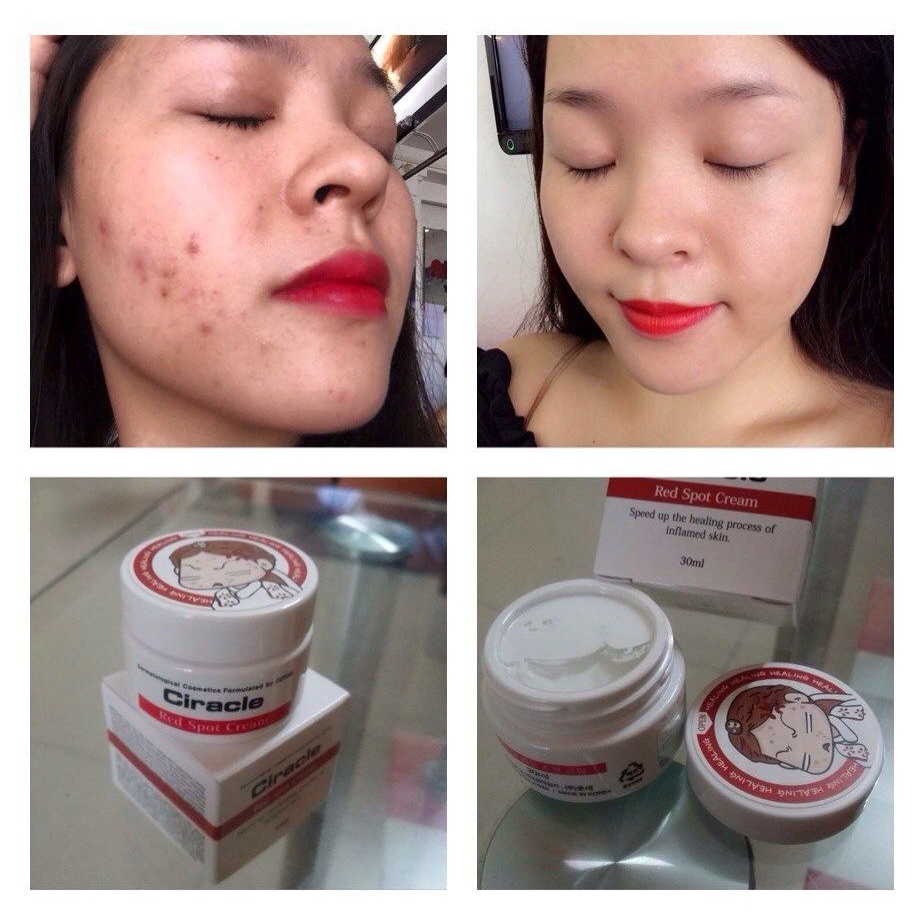 {XẢ KHO SỈ} Kem Giảm Mụn Ciracle Red Spot Cream 30g