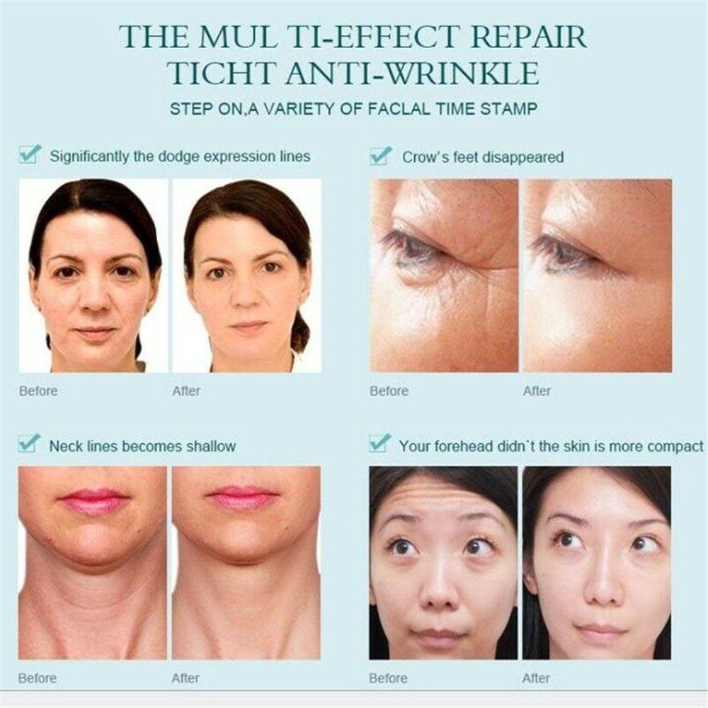 Serum Dưỡng Da Mặt Chống Lão Hóa Và Làm Săn Chắc Da