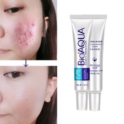 Kem giảm mụn Bioaqua Pure Skin Loại Bỏ Mụn Hiệu Qủa