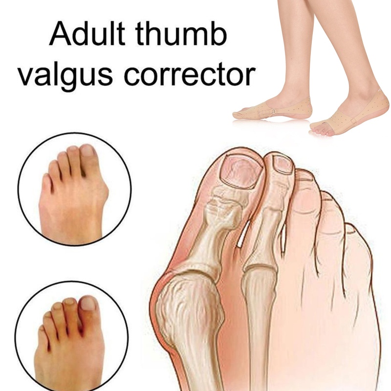 Dụng Cụ Nẹp Chỉnh Hình Ngón Chân Cái Chăm Sóc Giảm Đau