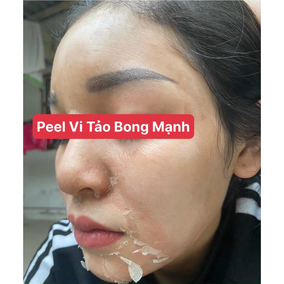 Peel da mặt vi tảo biển - tẩy da chết thay da sinh học cho mặt - Pell lột da mặt - tái tạo da mờ thâm nám