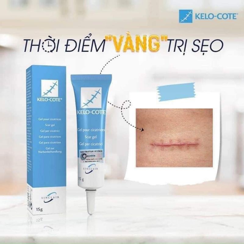 Kem Sẹo Lồi, Sẹo Lâu Năm, Sẹo Phẫu Thuật KELO - COTE 15G