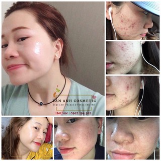 THANH LĂN MINI - NỬA LỌ NGỌC SÂM