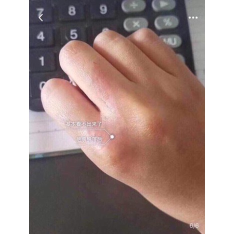 KEM MỜ SẸO GENTACIN SPA NHẬT BẢN - CỨU TINH MỌI LOẠI SẸO | BigBuy360 - bigbuy360.vn