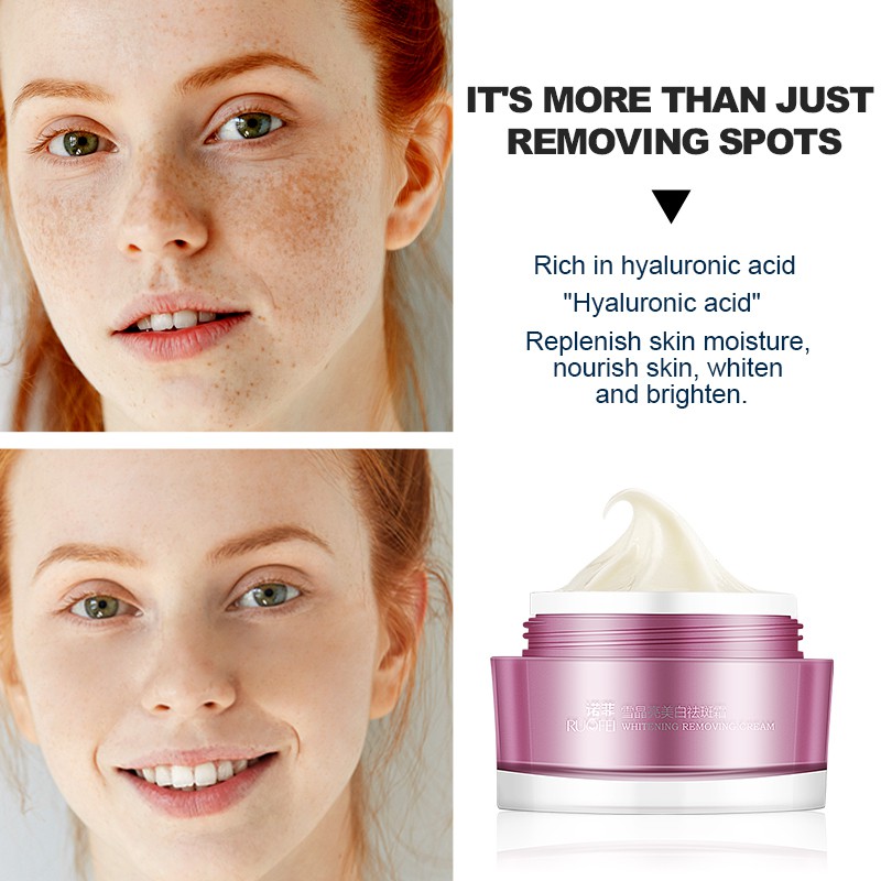 RUOALL Nở Ngực Huyết Thanh 30ML + Kem Set tàn nhang 30G