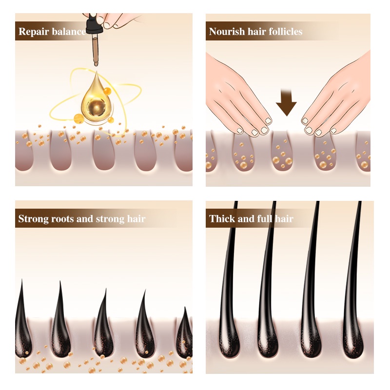 Serum kích thích mọc tóc KOPYRROL tinh chất sinh học cho nam nữ 30ml