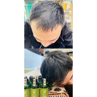 Dầu Gội Thảo Mộc THIÊN TRI 500ml