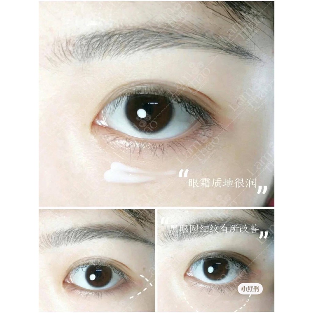 Kem Dưỡng Mắt Làm Sáng &amp; Chống Lão Hóa Meishoku Placewhiter Eye Cream